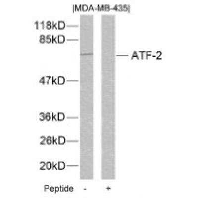 Western Blot: ATF2 [p Ser112, p Ser94] Antibody [NBP2-54641] - Western blot analysis of lysed extracts from MDA-MB-435 cells using ATF2 [p Ser112, pSer94]
